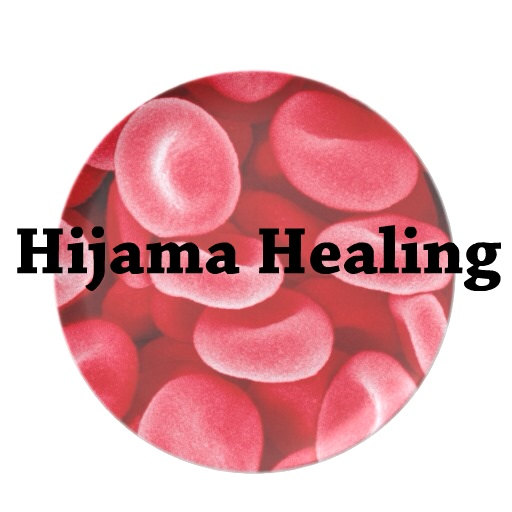 Hijama Healing Services